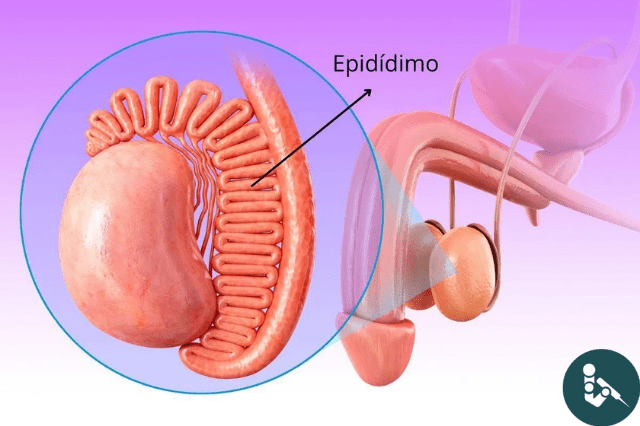 epididimite